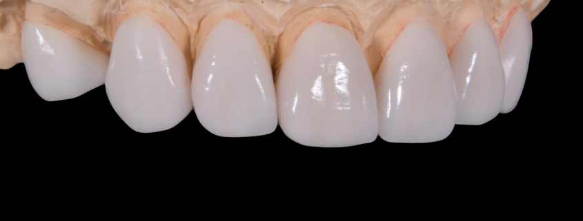 Impiantologia Dentale